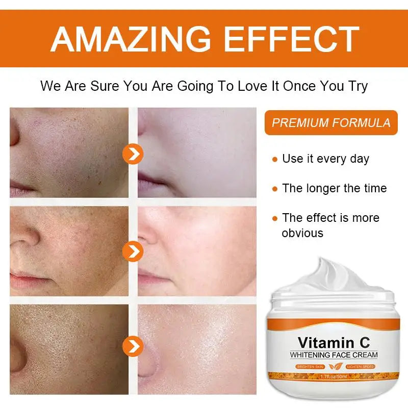 Creme facial de vitamina C remove manchas escuras clareamento cuidados hidratante antienvelhecimento antirrugas firmador cuidados com a pele cosméticos